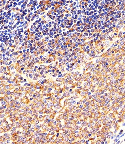 c-Src Kinase / CSK Antibody (aa67-101)