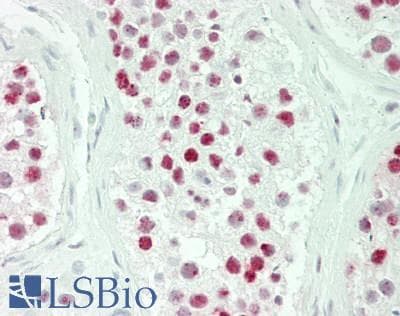 IHC-plus™ PELP1 Antibody (aa1000-1050)