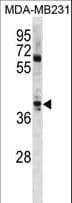ATOH1 / MATH-1 Antibody (aa310-338)