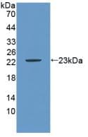 CA9 / Carbonic Anhydrase IX Antibody (aa88-280, APC)