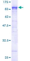 Human ACOX1 / ACOX Protein (Recombinant GST)