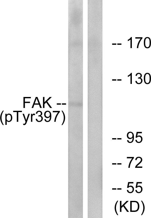 Polyclonal Rabbit anti-Human FAK / Focal Adhesion Kinase Antibody (phospho-Tyr397, WB)