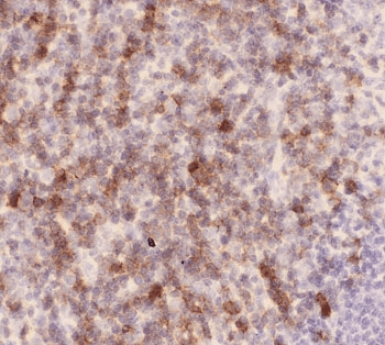 SPN / CD43 Antibody
