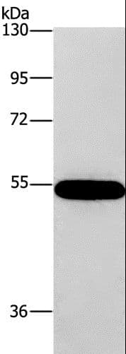 CNDP1 Antibody