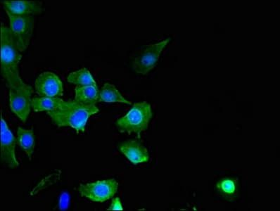 SPATC1L / C21orf56 Antibody