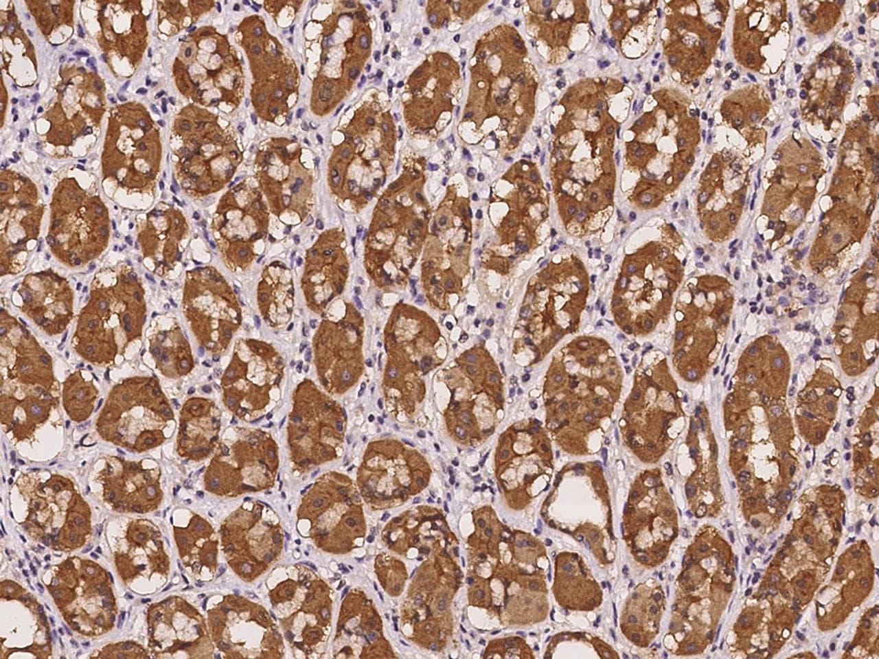Polyclonal Rabbit anti-Human STARD10 Antibody (IHC)
