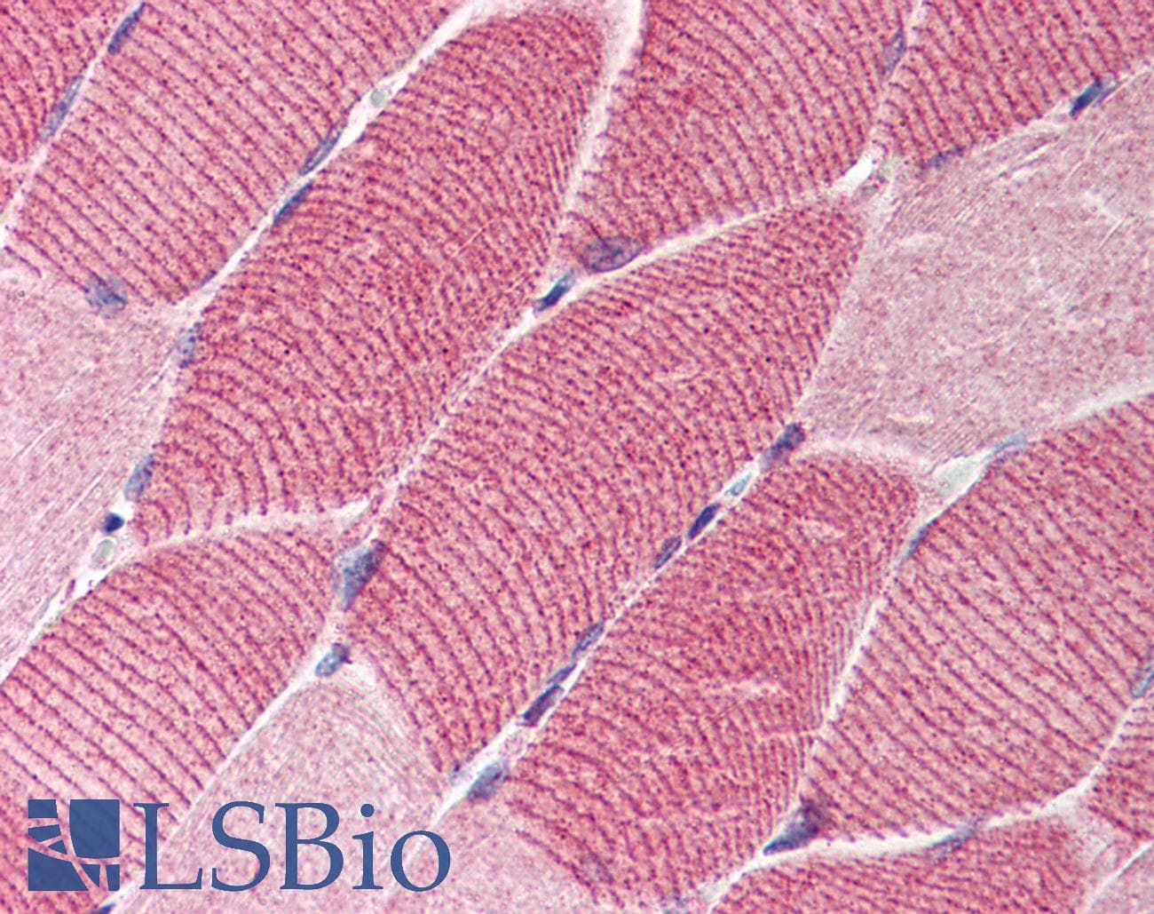 IHC-plus™ Hamartin / TSC1 Antibody