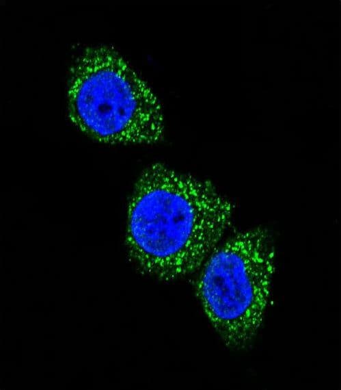 MEN1 / Menin Antibody (Thr594)
