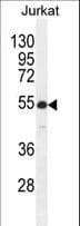 RBPJL Antibody (aa8-36)
