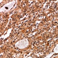 MATK Antibody
