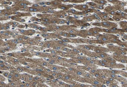 F2 / Prothrombin / Thrombin Antibody