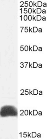 IL18 Antibody (IL-18, clone 125-2H)