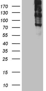 Monoclonal Mouse anti-Human TG / Thyroglobulin Antibody (clone OTI8A8, aa20-358, IHC, WB)
