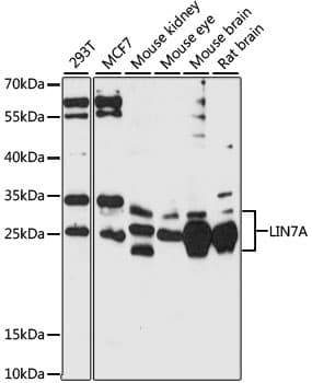 Polyclonal Rabbit anti-Human LIN7A Antibody (WB)