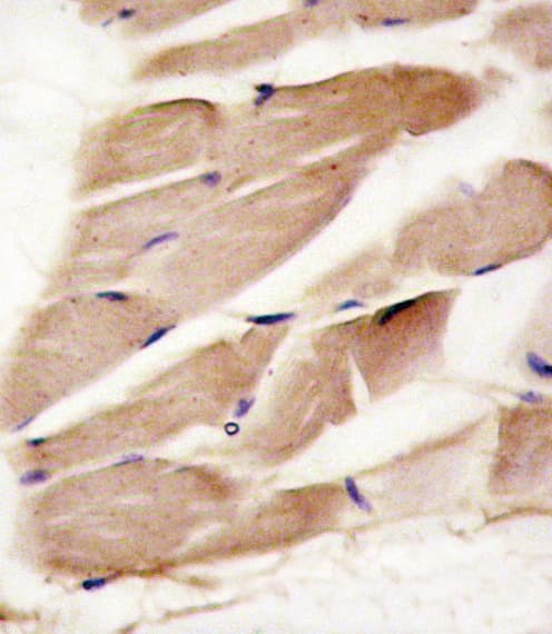 PRKAA2 / AMPK Alpha 2 Antibody (aa453-483)