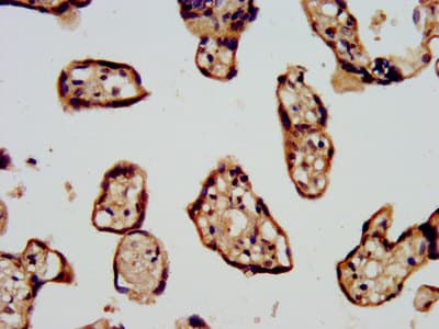 CDC42BPB / MRCKB Antibody
