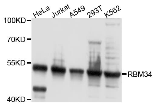 RBM34 Antibody