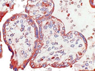 CCRL2 Antibody (clone 1B2)