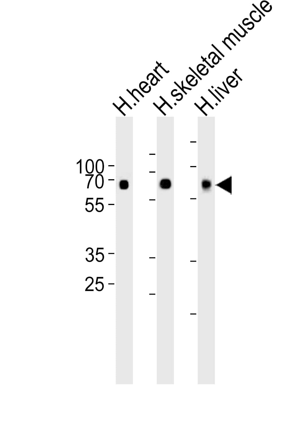 Polyclonal Rabbit anti-Human CRY2 Antibody (aa564-593, IHC, WB)