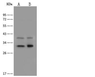 DECR1 Antibody (Preservative Free)