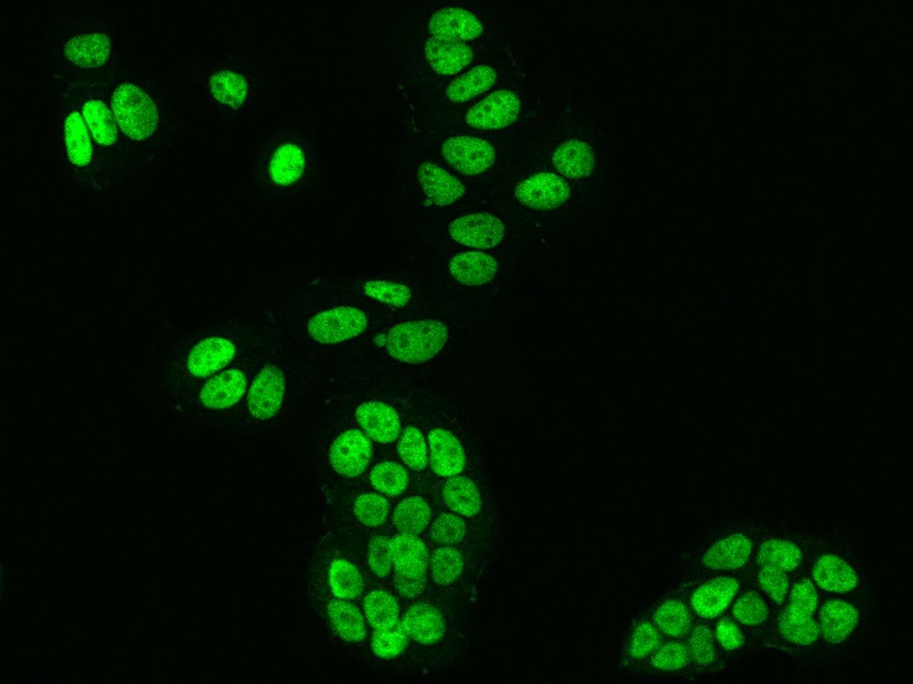 Polyclonal Rabbit anti-Human FOXA1 Antibody (IHC, IF)