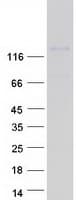 Human ITGA3 / CD49c Protein (Recombinant Myc-DDK (Flag))