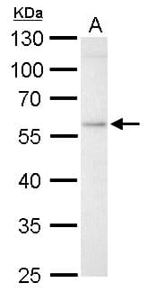 GBA / Glucosidase Beta Acid Antibody (aa65-384)