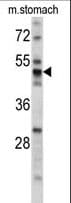 PDIA6 / ERP5 Antibody (aa144-172)