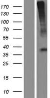 Human GHRHR Protein (Over-Expression Lysate Myc-DDK (Flag))