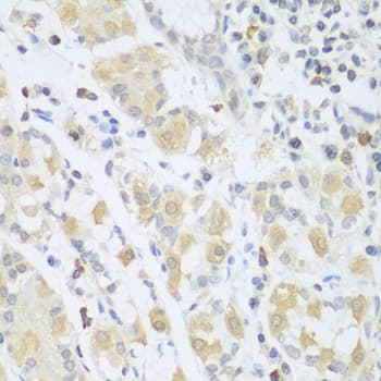 SGCB / SGC / Sarcoglycan Beta Antibody
