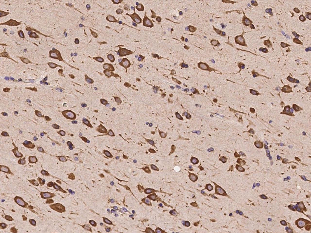 Polyclonal Rabbit anti-Human CAPRIN1 Antibody (IHC, IF)