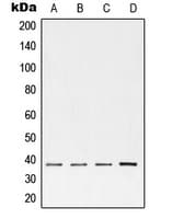 TNNT2 / CTNT Antibody (Internal)