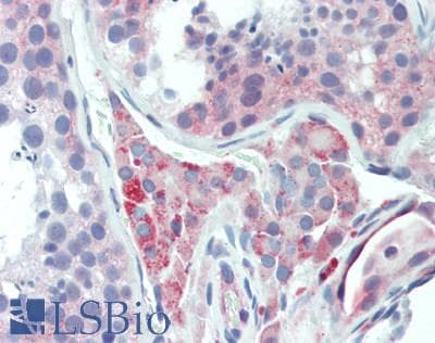 Polyclonal Rabbit anti-Human UCN2 / SRP Antibody (aa20-112, IHC, WB)