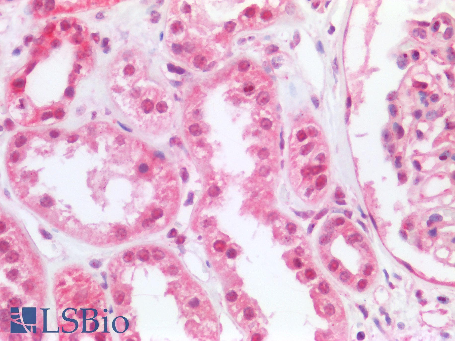 PathPlus™ p84 / THOC1 Antibody (aa1-404)