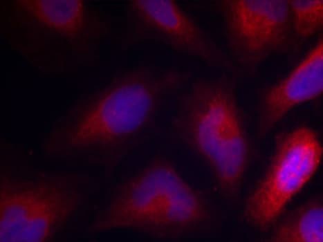 MARCKS Antibody (phospho-Ser162)