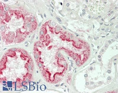IHC-plus™ Polyclonal Rabbit anti-Human FOLR1 / Folate Receptor Alpha Antibody (IHC, WB)