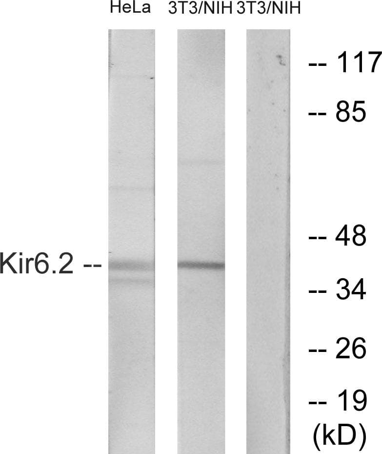 Polyclonal Rabbit anti-Human KCNJ11 / Kir6.2 Antibody (p224, IHC, IF, WB)