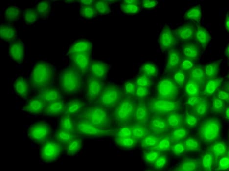 Cullin 4B / CUL4B Antibody