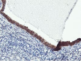 FBXO21 Antibody (clone OTI2B8)