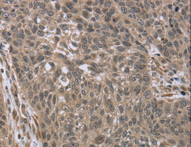 IL15RA Antibody