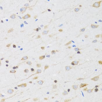 CHRM5 / M5 Antibody