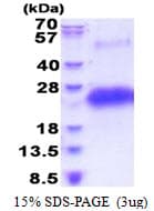 Human CD40 Protein (Recombinant His)