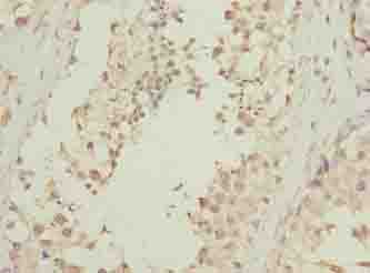 Polyclonal Rabbit anti-Human DNALI1 Antibody (IHC, WB)