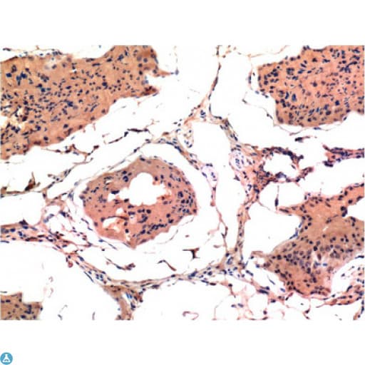 Monoclonal Mouse anti-Human BAX Antibody (IHC, WB)