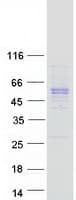 Human SERPINE1 / PAI-1 Protein (Recombinant Myc-DDK (Flag))