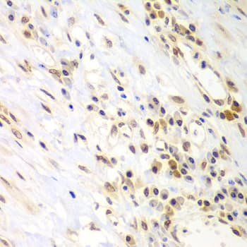 LHX4 Antibody
