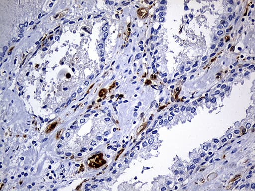 M-PST / STM Antibody (clone OTI6A8)