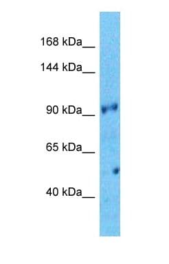 Polyclonal Rabbit anti-Human WDR75 Antibody (N-Terminus, WB)