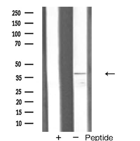 Polyclonal Rabbit anti-Human VEGFD Antibody (IHC, WB)