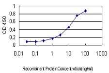 IHC-plus™ Monoclonal Mouse anti-Human Endothelin 3 / EDN3 Antibody (clone 2A6-2A4, IHC, WB)